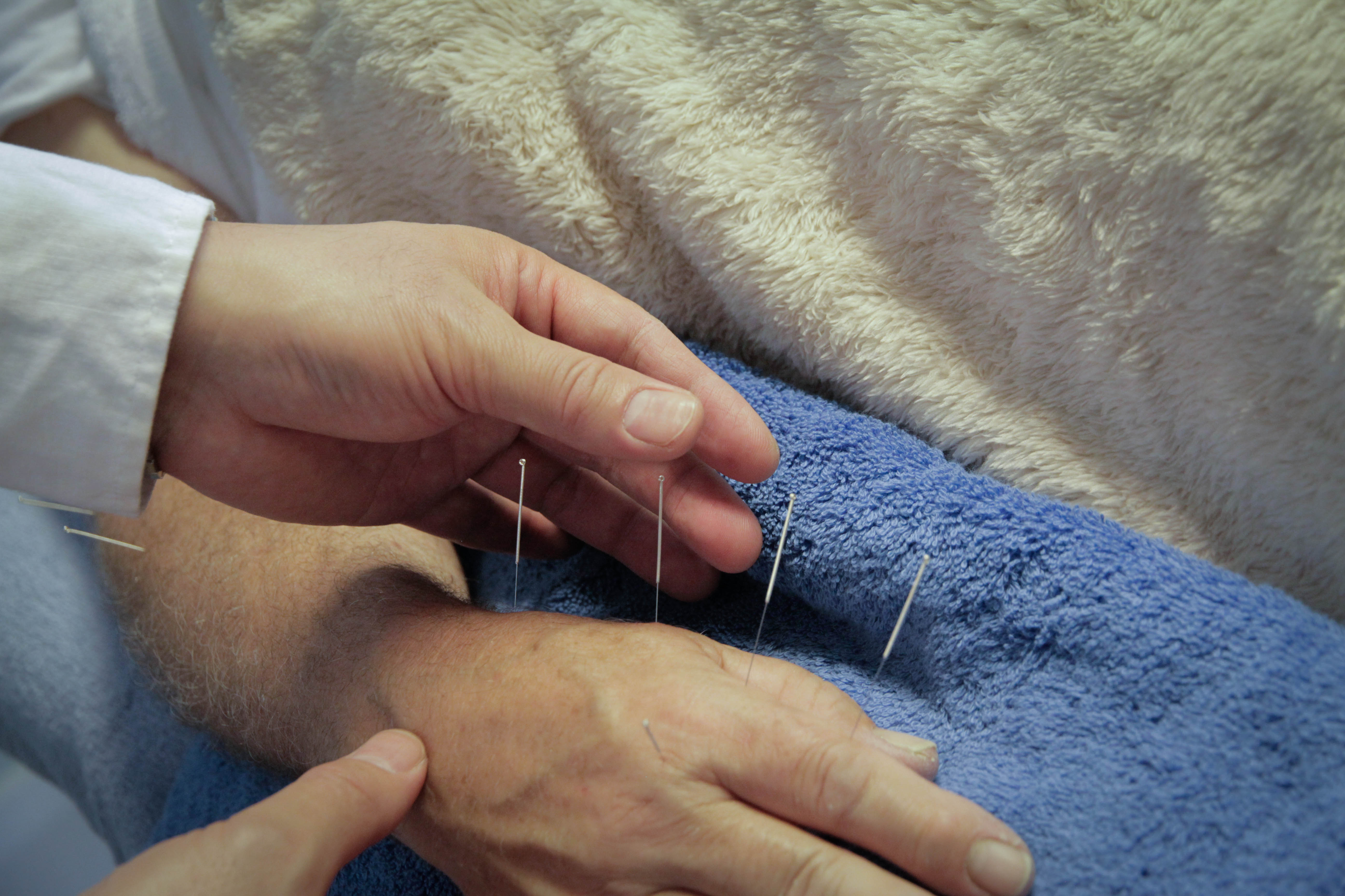 Acupuncture Beehive Healthcare